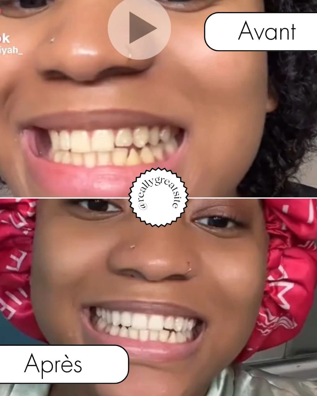 Bandes dentaires 5D White — visuel 4