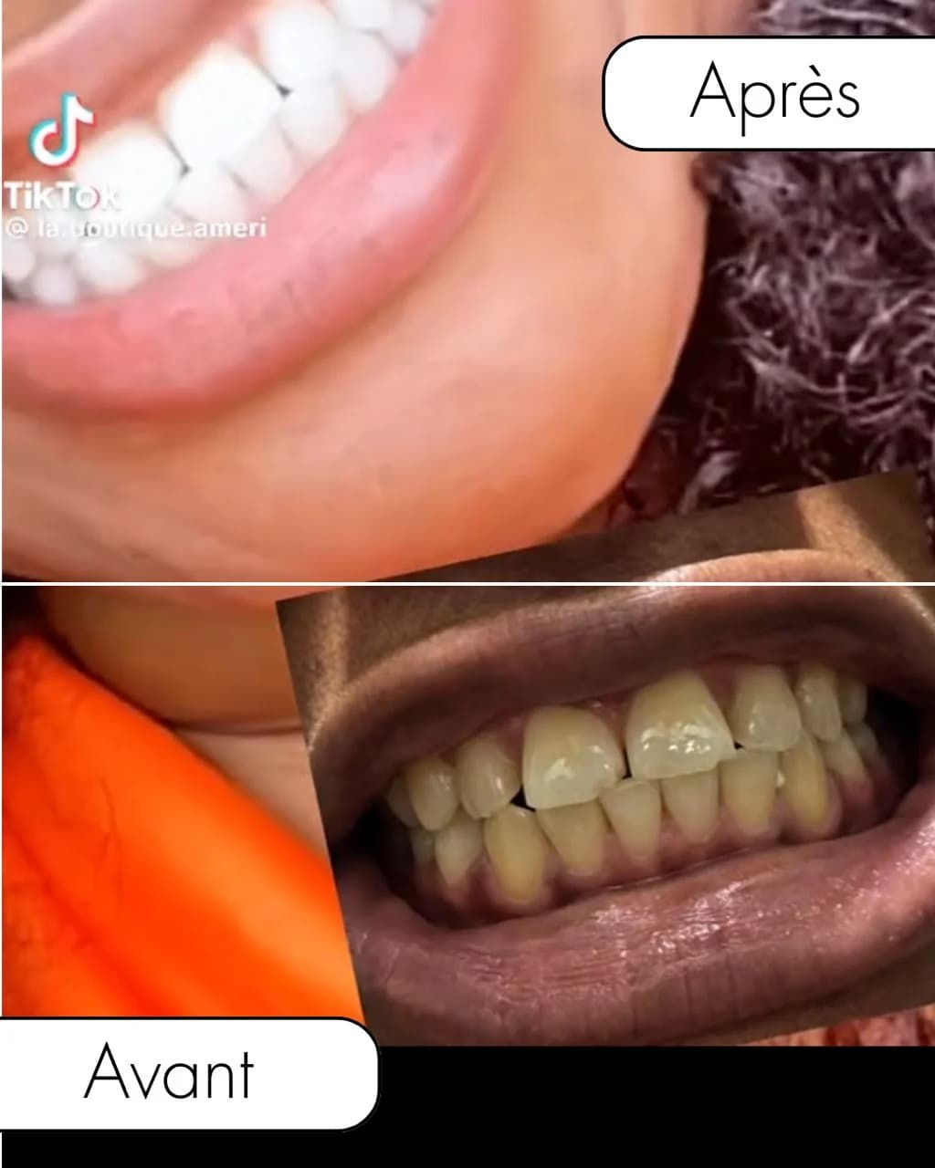 Bandes dentaires 5D White — visuel 2